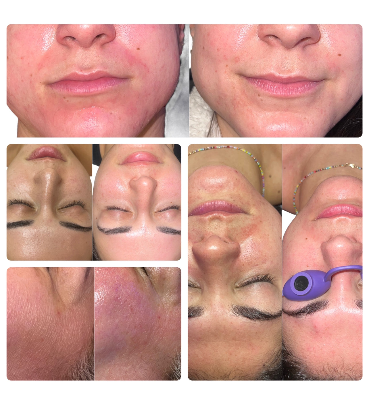 1 seller XF post care method (without led) – X Formulations