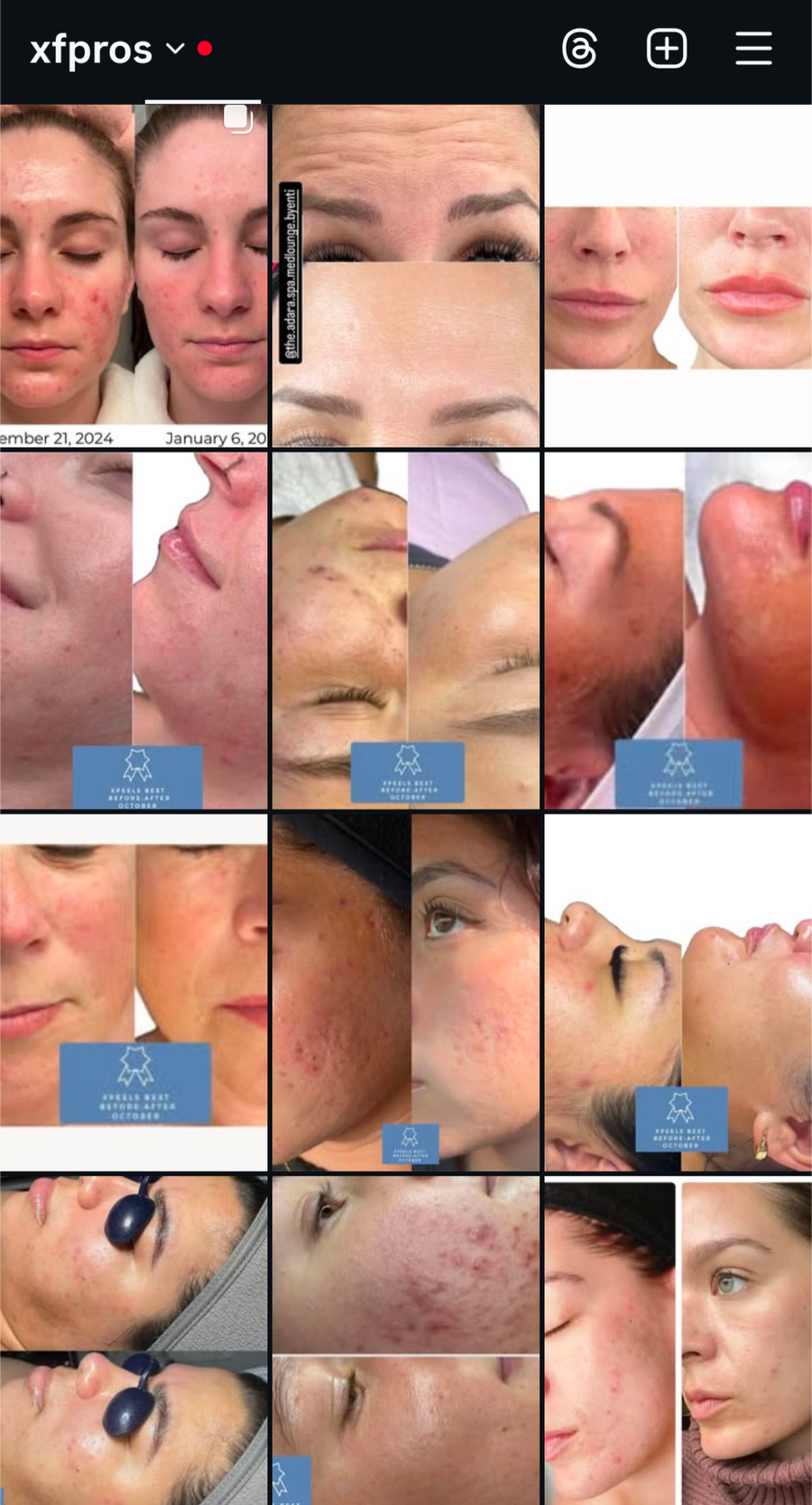 1. Oregon Esthetics Show: 5 hour peel certification by Julie Grosso/Georgia Hurley : Oregon aesthetic show early bird special
