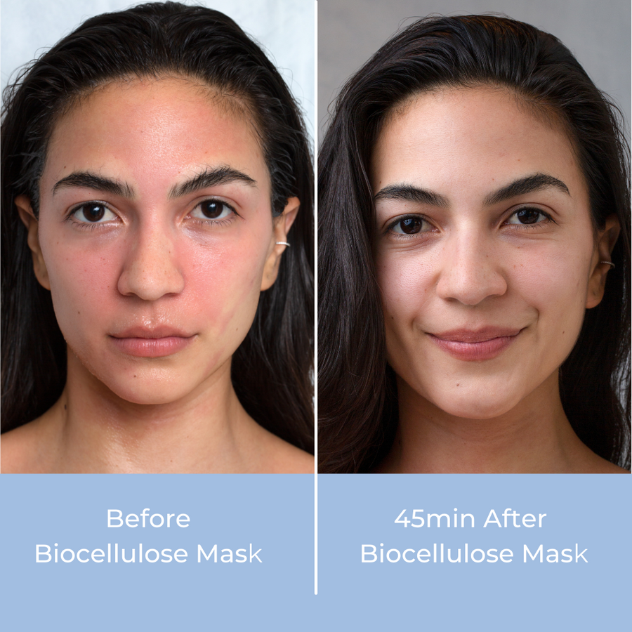 #1 seller Biocellulose Face Mask (6 pack)