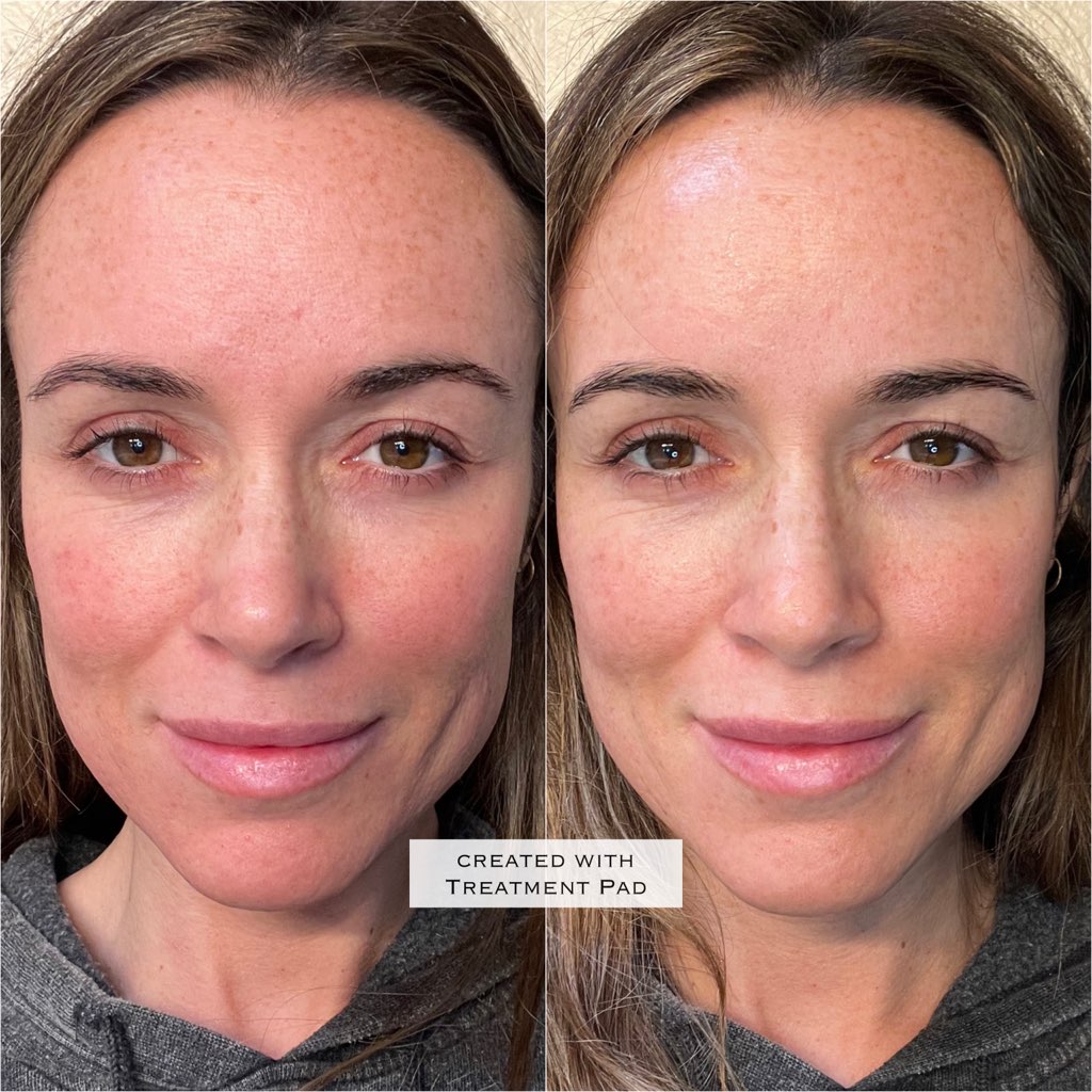 Biocell Repair Face Mask (3 pack) – X Formulations